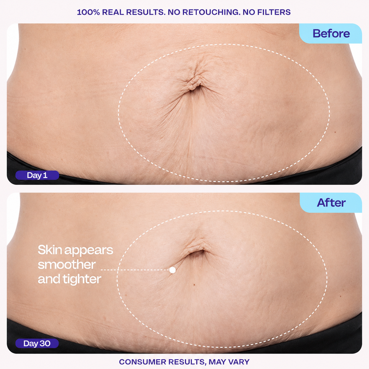 GOPURE Tighten & Smooth Belly Cream