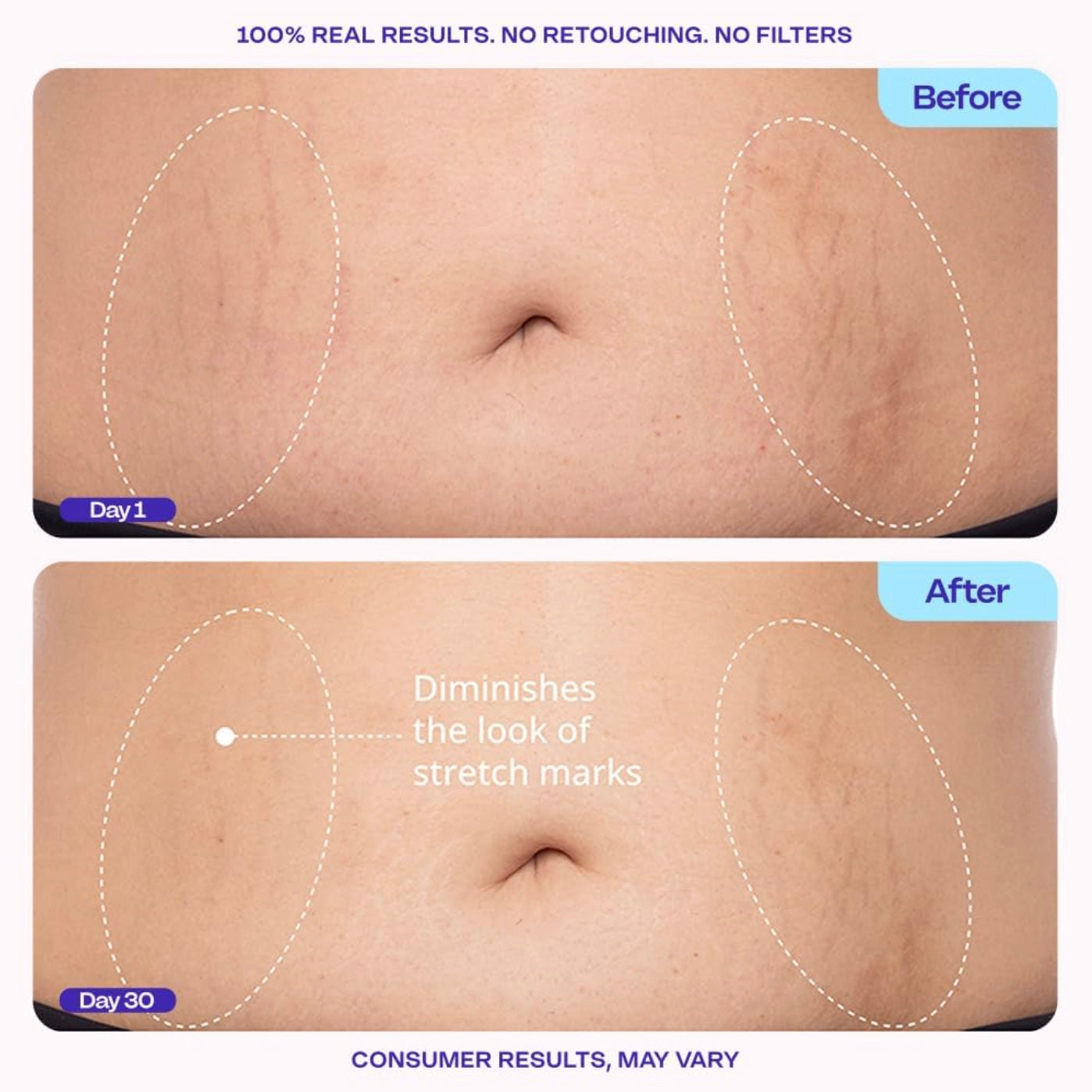 GOPURE Tighten & Smooth Belly Cream